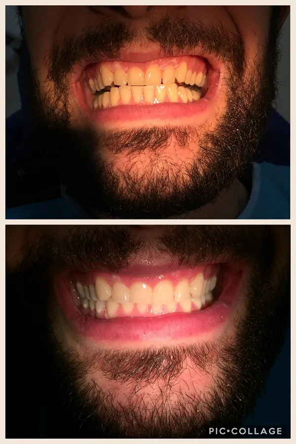 dental treatment 2