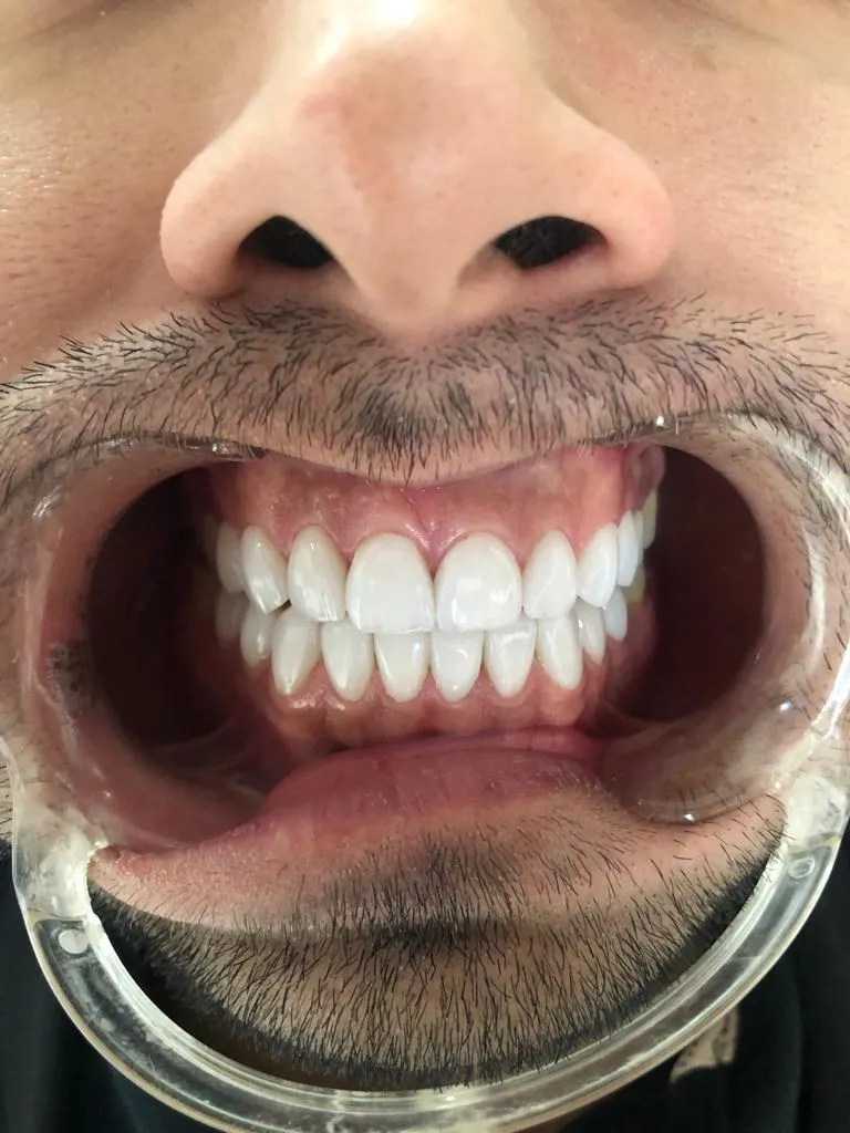 dental treatment 3